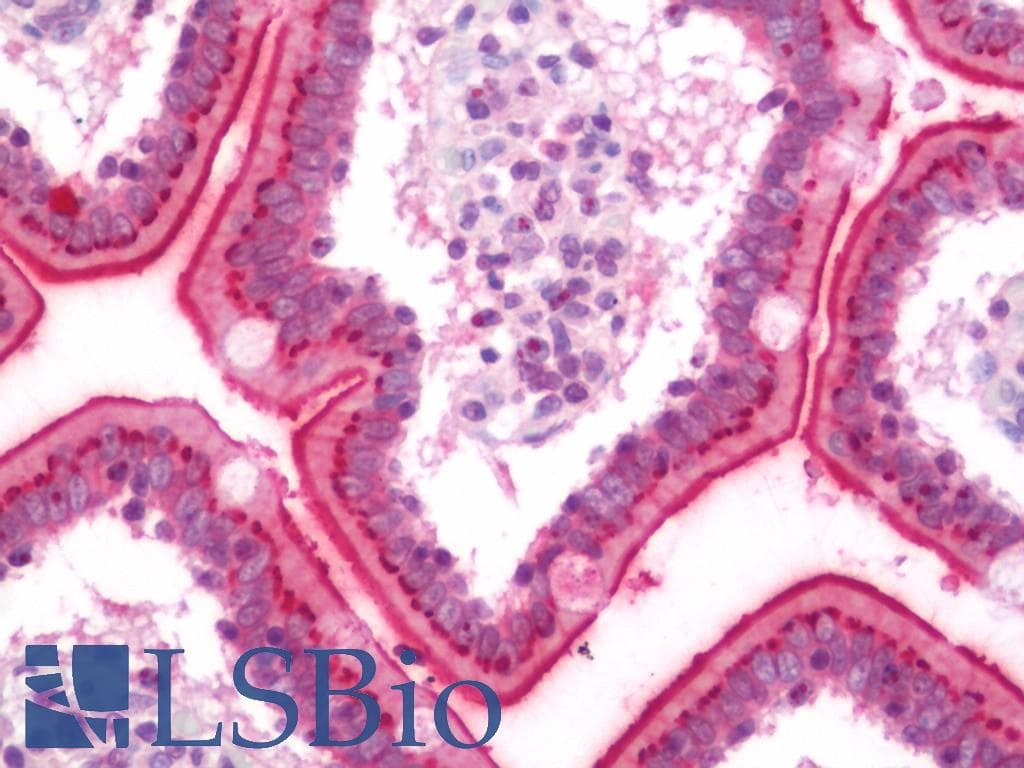 IHC-plus™ CTNNB1 / Beta Catenin Antibody (clone 1H10)