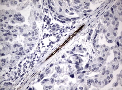 Adiponectin Antibody (aa19-244, clone UMAB104)