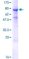 Human INTU Protein (Recombinant GST)