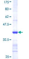 Human CSAD / CSD Protein (Recombinant GST, N-terminus)