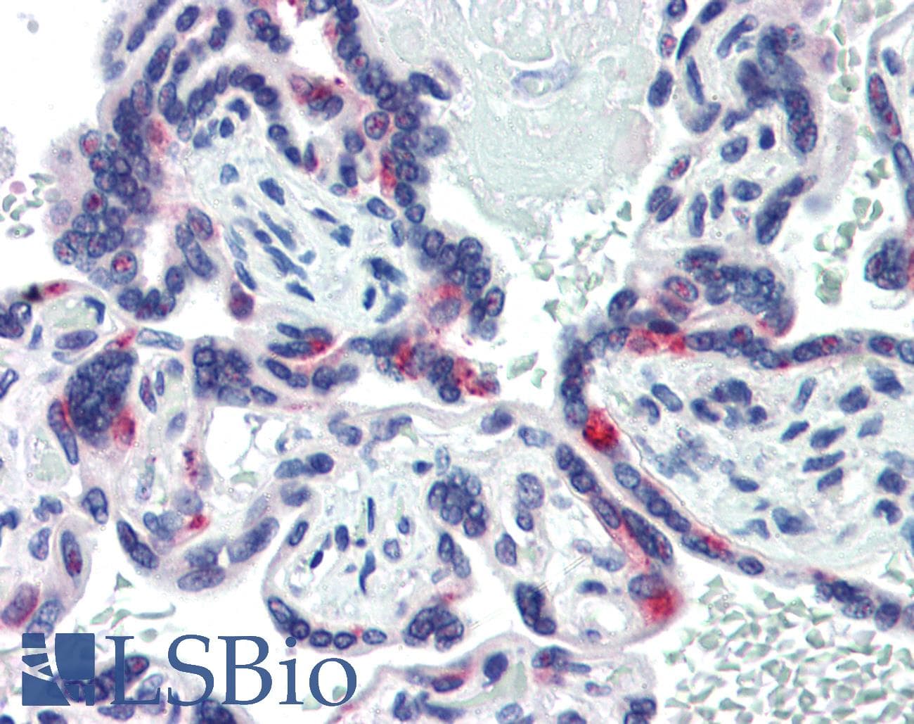 SIN3A Antibody (N-Terminus)