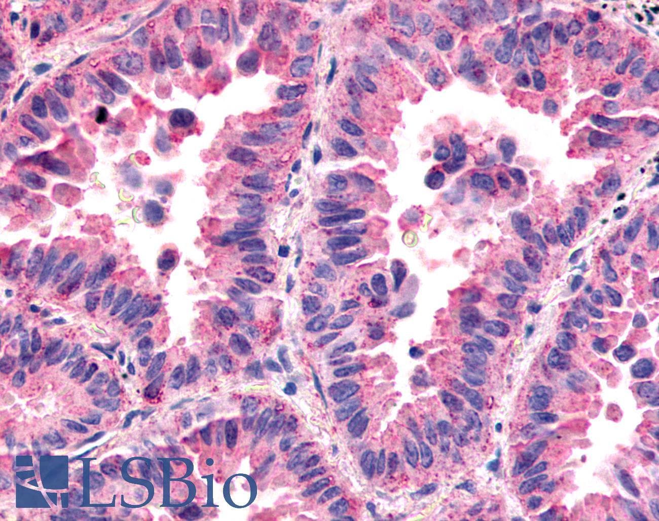 PathPlus™ HNF4G / HNF4 Gamma Antibody (Internal)