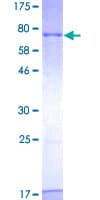 Human STK25 Protein (Recombinant GST)