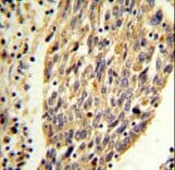 PKM / Pyruvate Kinase, Muscle Antibody (aa116-145)
