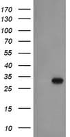 EXOSC3 Antibody (clone OTI1D6)