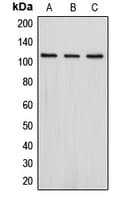 DLG2 / PSD93 Antibody (Internal)