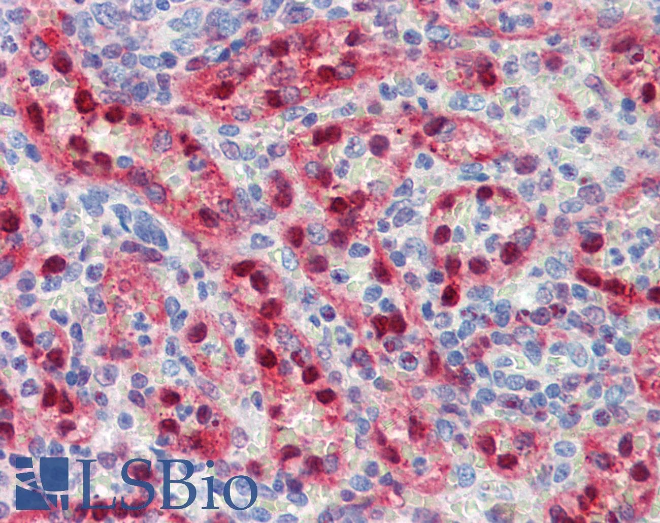 IHC-plus™ Polyclonal Rabbit anti-Human PIGY Antibody (IHC, IF, WB)