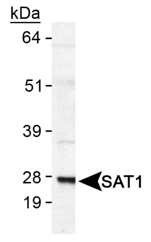 SAT1 / SAT Antibody (aa100-171)