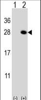 Polyclonal Rabbit anti-Human QDPR / DHPR Antibody (aa218-243, IHC, WB)