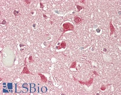IHC-plus™ CARS1 / CARS Antibody