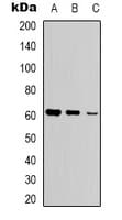 Polyclonal Rabbit anti-Human GK / Glycerol Kinase Antibody (N-Terminus, IHC, WB)