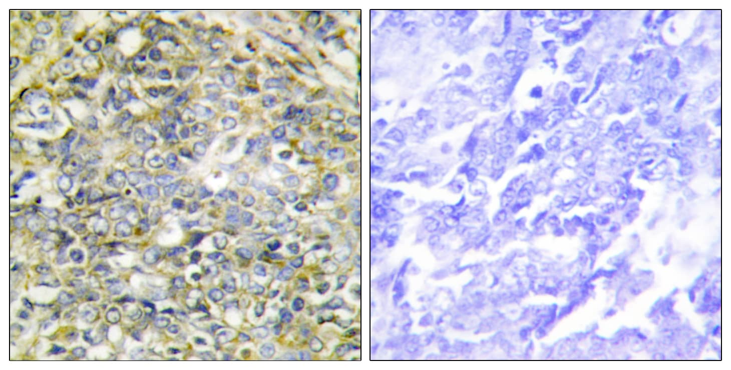 UBXN11 / SOC Antibody (aa131-180)