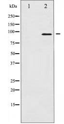 FOXO3 / FOXO3A Antibody