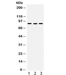 Polyclonal Rabbit anti-Human MLH1 Antibody (WB)
