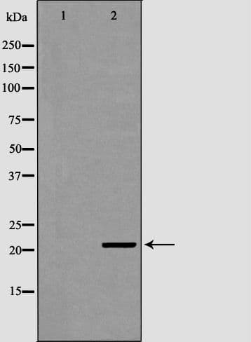 ITPA Antibody