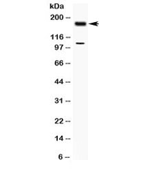 TIAM1 Antibody