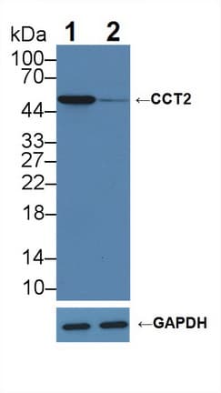 CCT2 / CCT Beta Antibody (aa1-488)