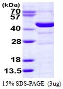 Human SMS / Spermine Synthase Protein (Recombinant His)
