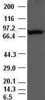 POSTN / Periostin Antibody (clone OTI1A1)