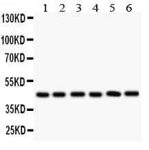 IL2RA / CD25 Antibody (aa39-57)
