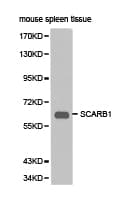 SCARB1 / SR-BI Antibody