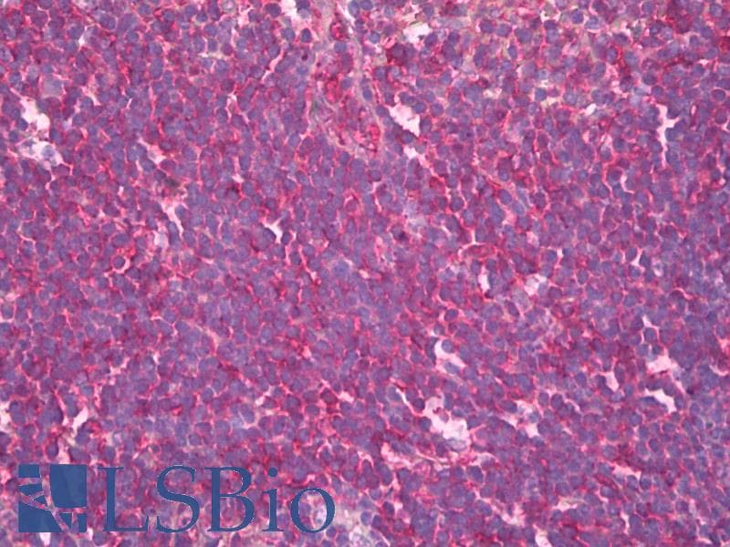 IHC-plus™ Polyclonal Rabbit anti-Human HAVCR2 / TIM-3 Antibody (aa176-194, IHC)