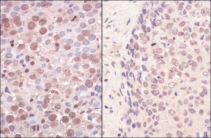 SMCHD1 Antibody (aa250-300)
