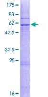 Human COX18 Protein (Recombinant GST)