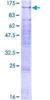 Human FANCB / FAB Protein (Recombinant GST)