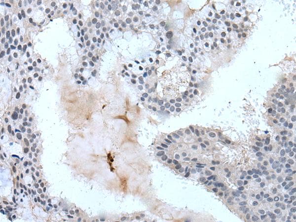 Polyclonal Rabbit anti-Human ZBTB3 Antibody (IHC, WB)