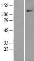 POLR1B Protein (Over-Expression Lysate Myc-DDK (Flag))