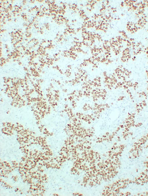 SALL4 Antibody (clone ABT-SALL4)