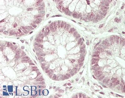 IHC-plus™ Capicua / CIC Antibody (aa1548-1608)