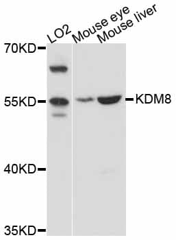 KDM8 / JMJD5 / FLJ13798 Antibody