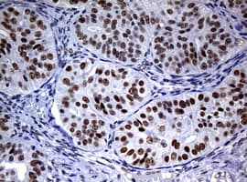 NBN / Nibrin Antibody (aa461-754, clone OTI1G10, Carrier-free)