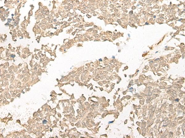 Polyclonal Rabbit anti-Human COMT Antibody (IHC, WB)