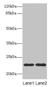 Polyclonal Rabbit anti-Human ASF1B Antibody