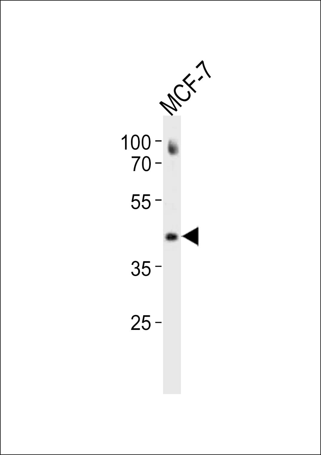 ESR2 / ER Beta Antibody (aa499-527)