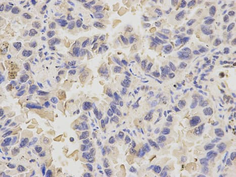PDE1B Antibody