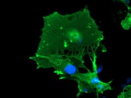 LIMK1 / LIMK Antibody (clone OTI6B4)