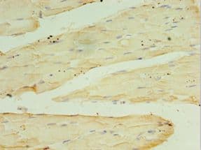 Polyclonal Rabbit anti-Human RPH3AL Antibody (aa161-315, IHC, WB)