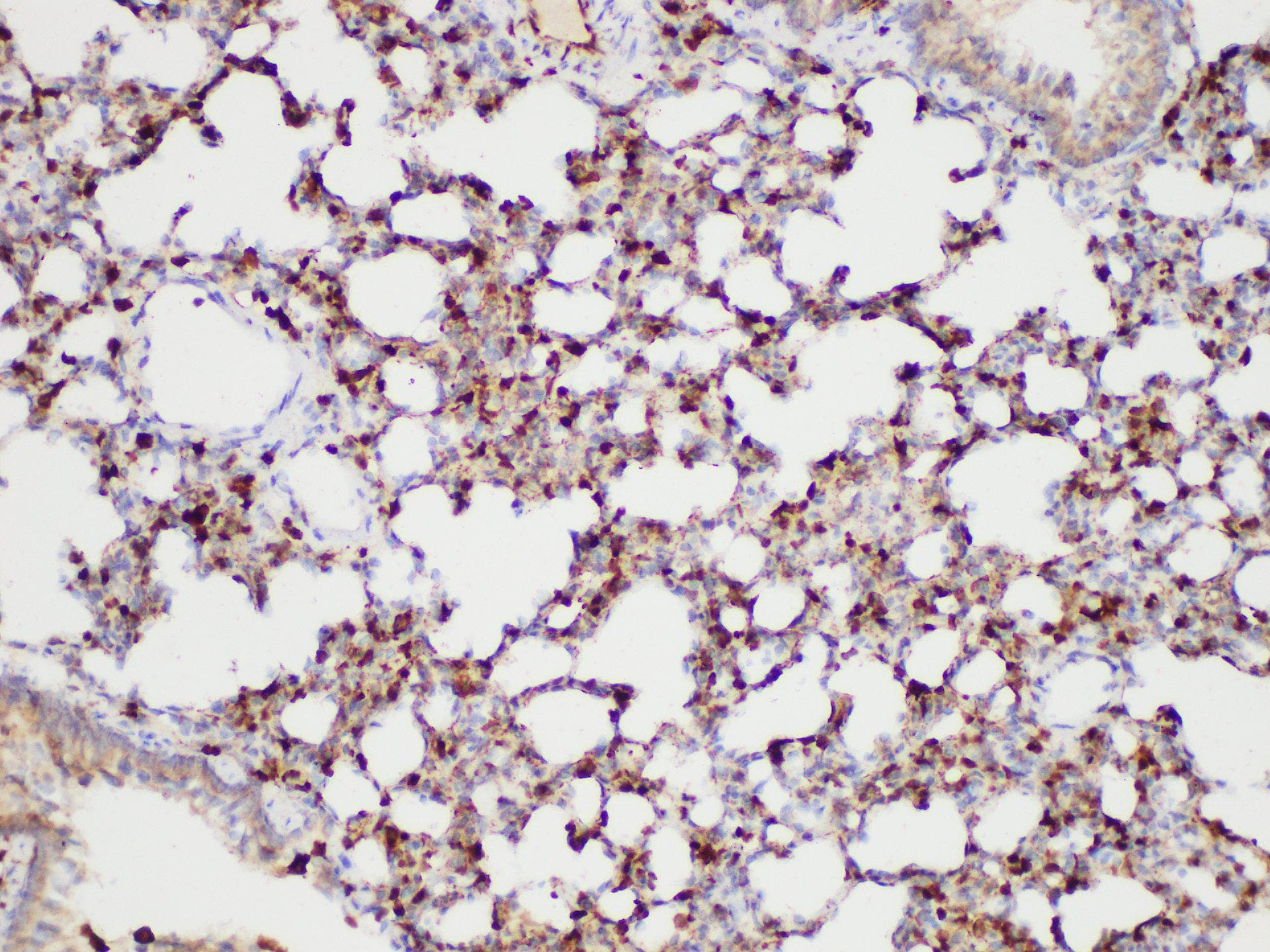 S100A4 / FSP1 Antibody