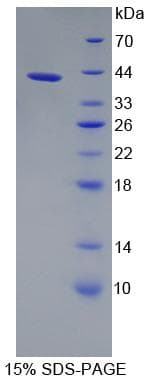Human OGDH Protein (Recombinant His-T7)