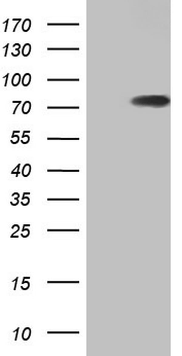 Monoclonal Mouse anti-Human HNRNPL / hnRNP L Antibody (clone OTI9G7, aa270-502, IHC, WB)
