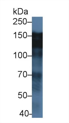 EGFR Antibody (aa888-1210, Cy3)