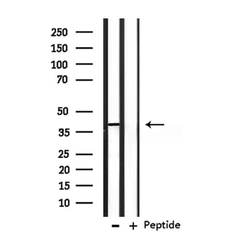 OPCML / OBCAM Antibody