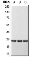 DHRS2 / HEP27 Antibody (Internal)