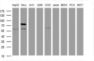 Monoclonal Mouse anti-Human TICAM1 / TRIF Antibody (clone OTI1G7, WB)