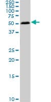 SMAD1 Antibody (clone 2E9)
