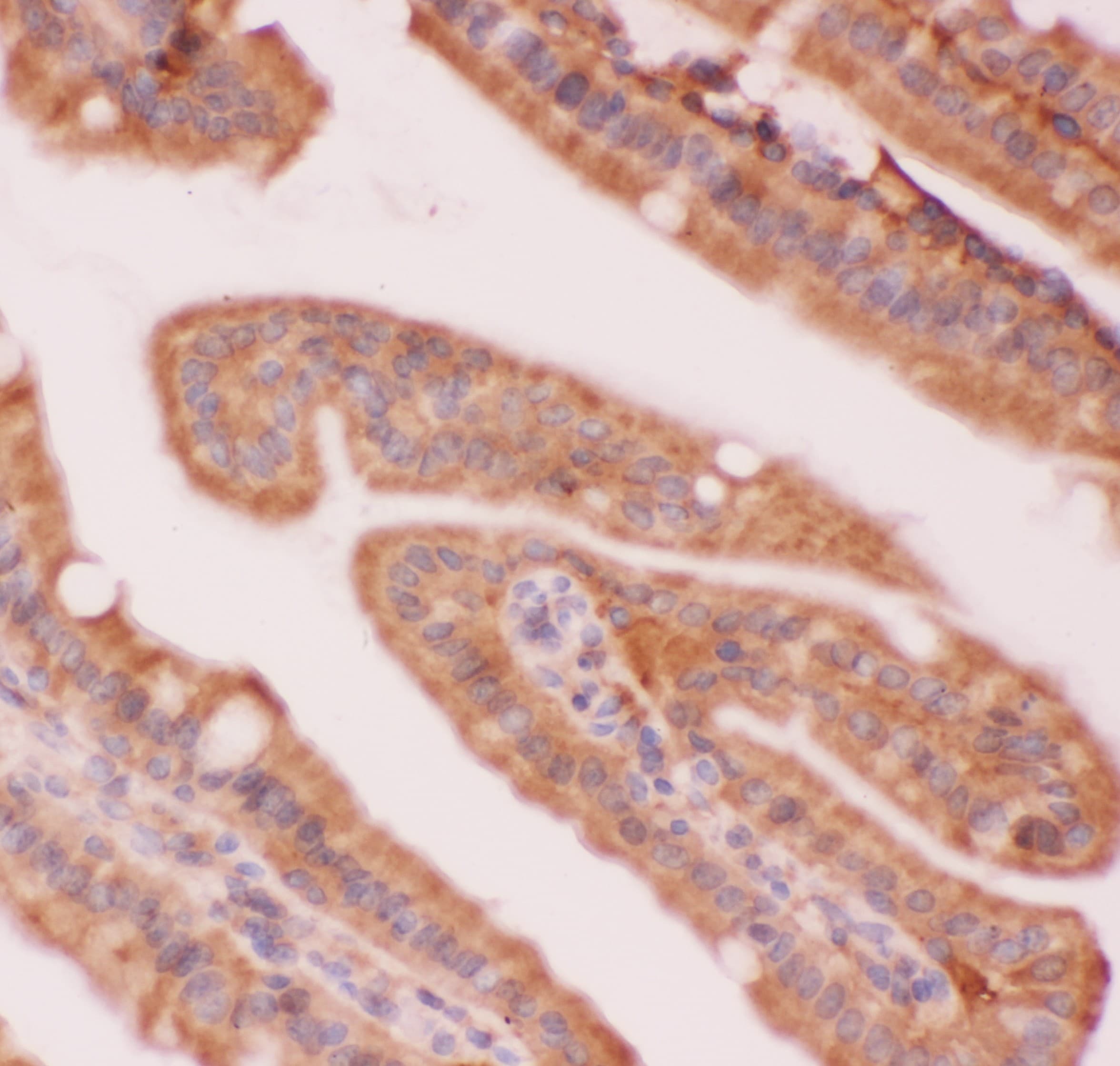 NFKB2 Antibody (aa1-340)